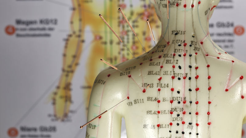 Die Reizung der Akupunkturpunkte z.B. durch feine Nadeln führt durch Stimulation von Nervenendigungen zu direkten Effekten am Rückenmark und in Teilen des Gehirns.